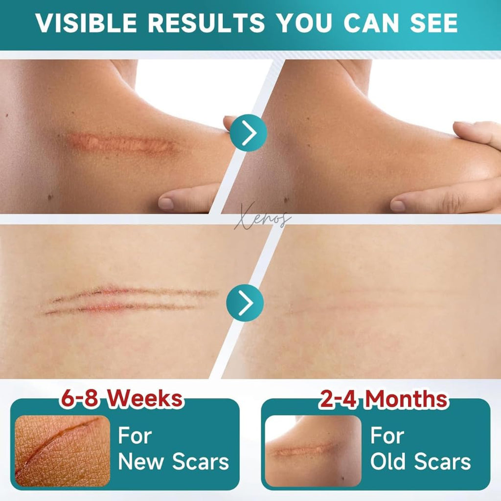 Chemical Free Scar Tape